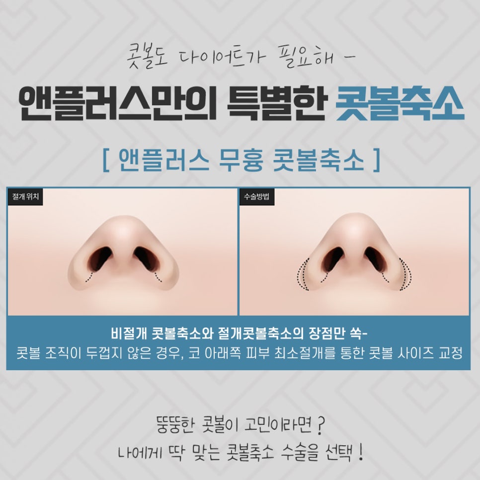 Reviewing Nostril Reduction Results and Improving Your Appearance image 8
