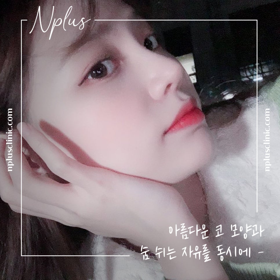 자가늑코성형 후기까지 확인하고 관련 이미지 2