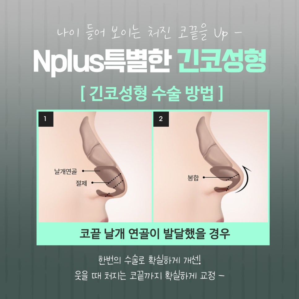 긴코수술을 통해 동안으로 관련 이미지 10