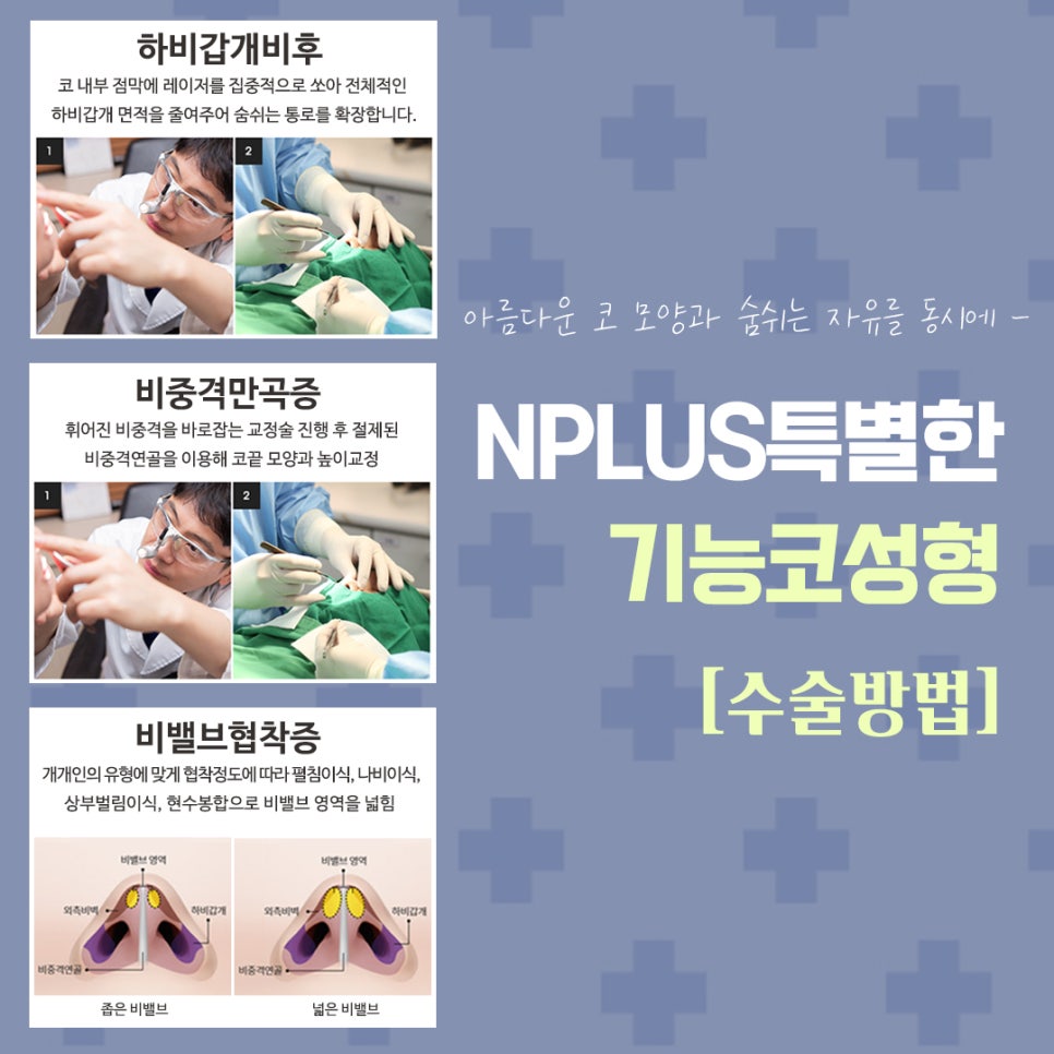 코수술보험 확실하게 알아보고 진행해야 관련 이미지 8