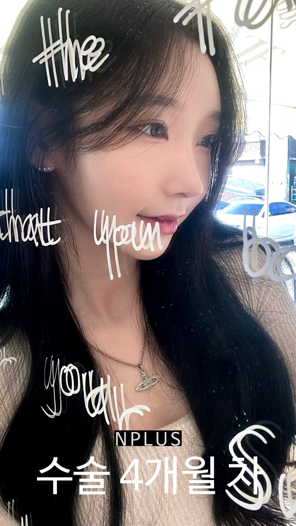 기본코성형후기 절골 + 무보형물 코성형 + 코끝 비중격 연골, 귀 연골 관련 이미지 11