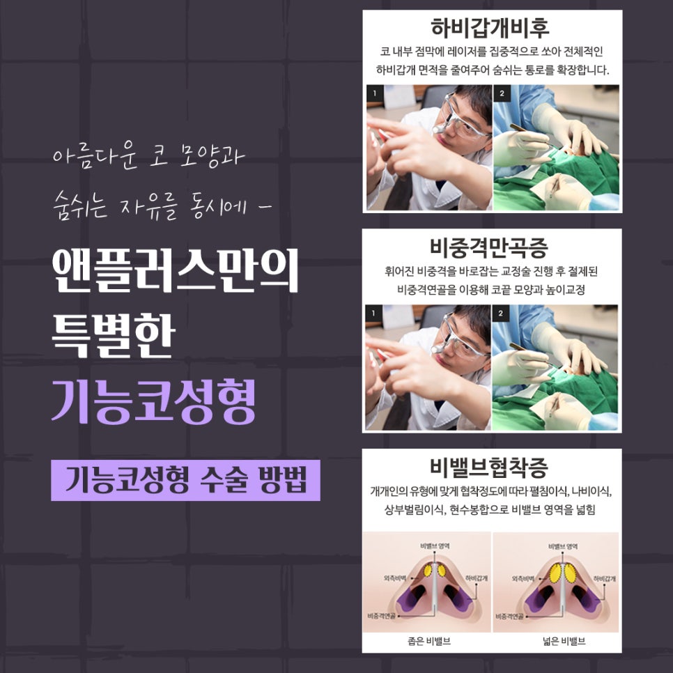코성형후기 만족스러운 결과 관련 이미지 9