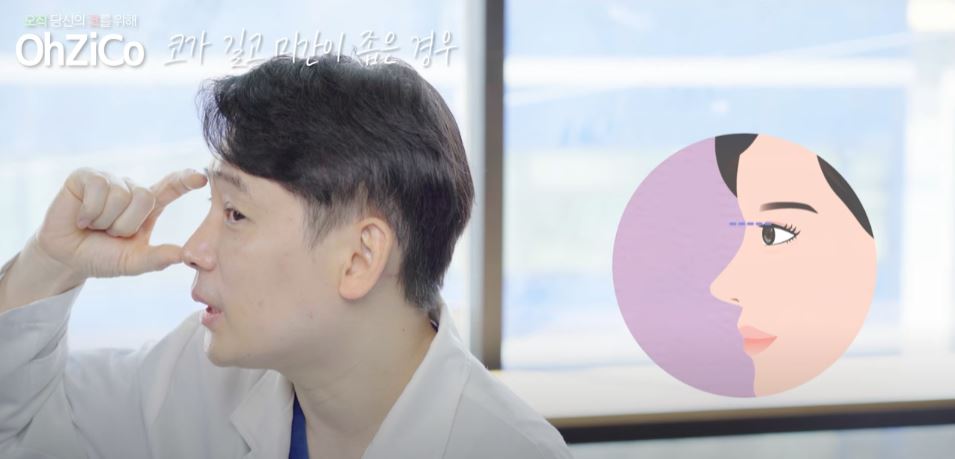 코성형 후 눈몰림 걱정된다면? 관련 이미지 24