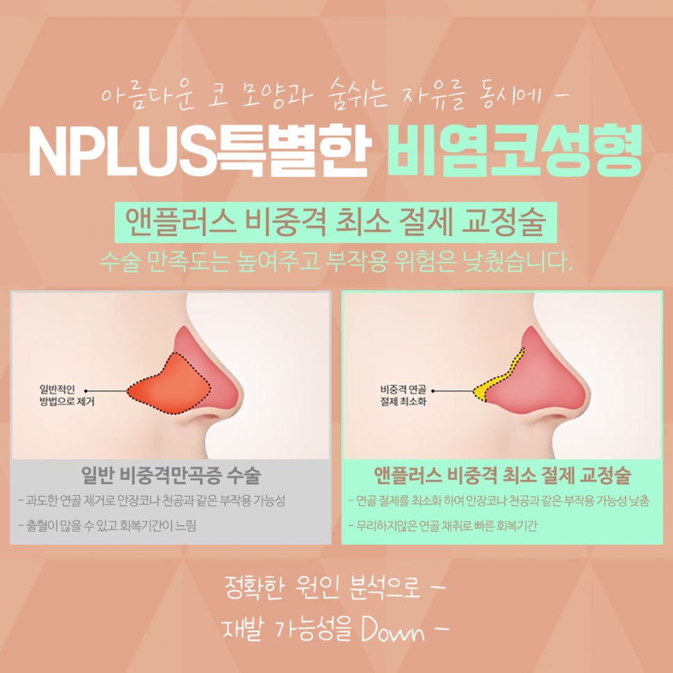 Nasal Surgery Review, Considering a Beautiful Nose Line image 12