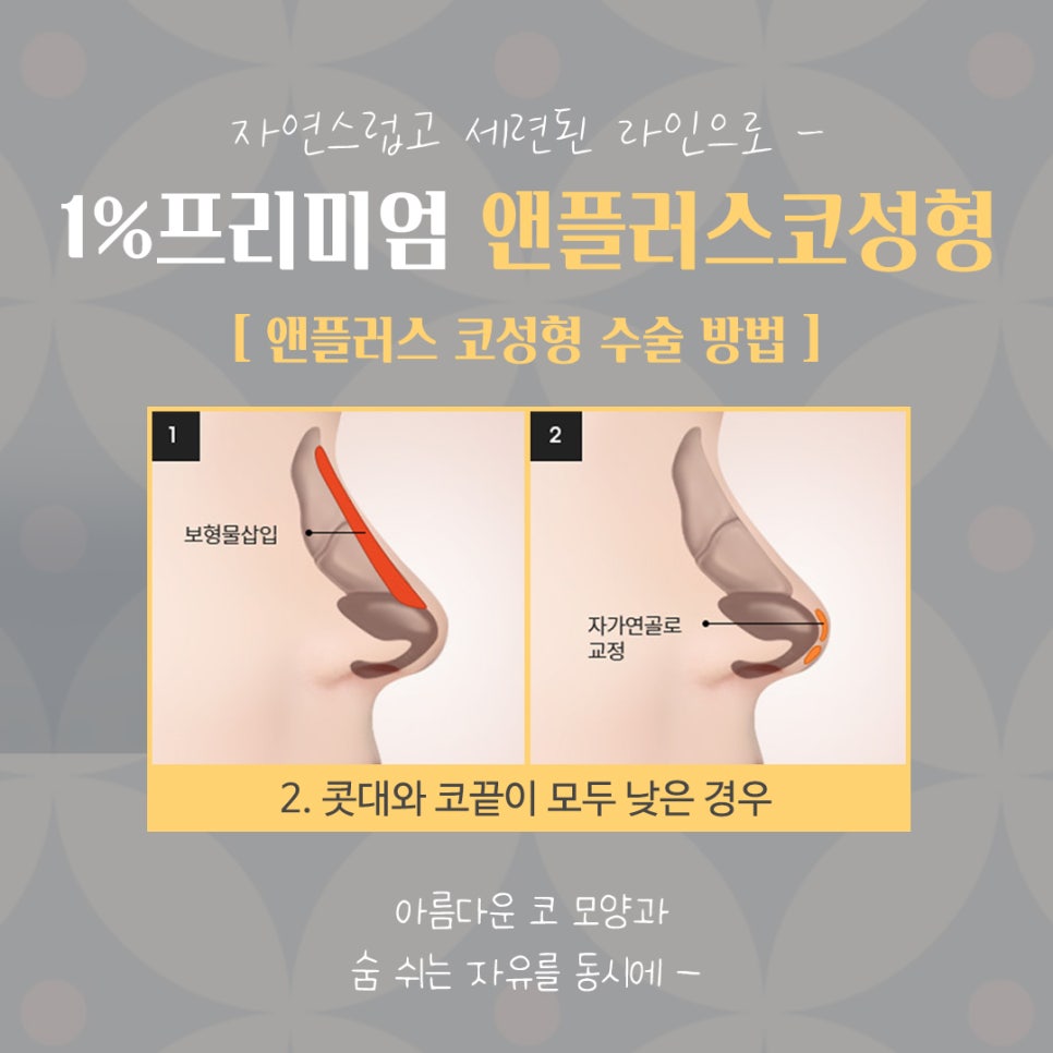 자가늑연골코수술 세련된 이미지로 관련 이미지 10