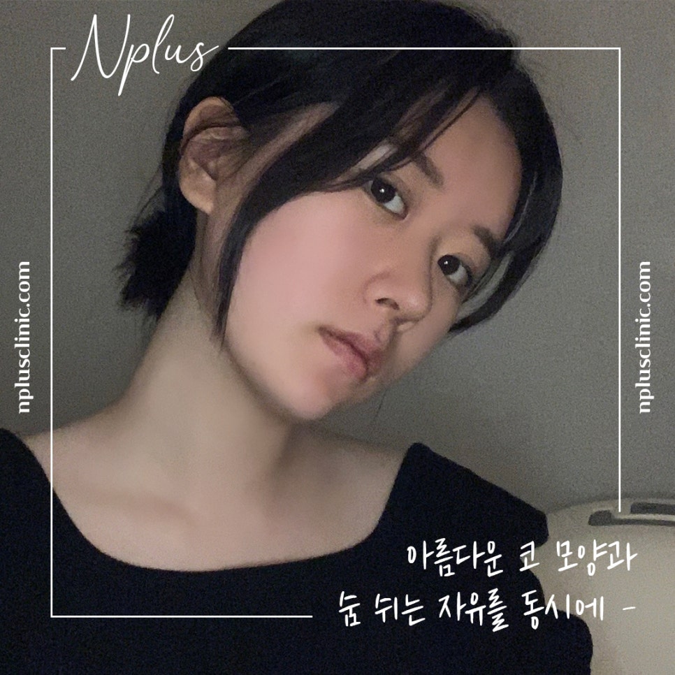 코수술후기 라인까지 고려해서 관련 이미지 1