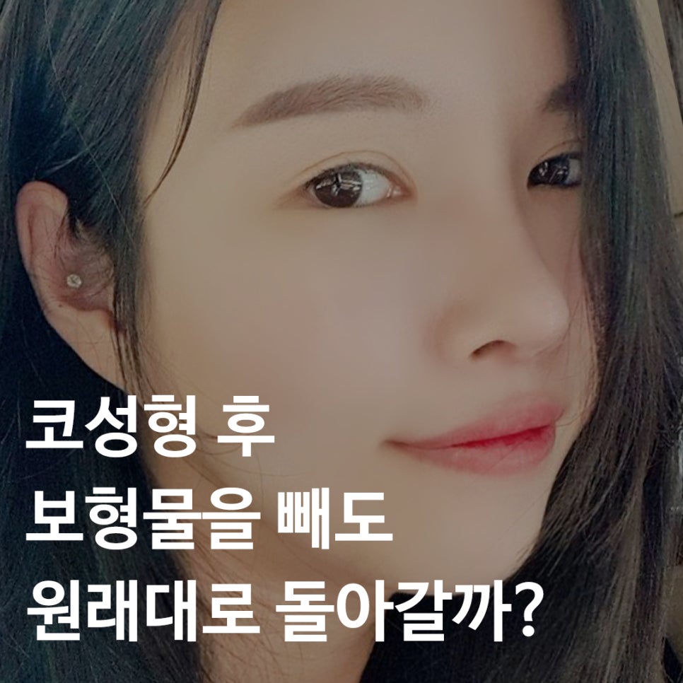 코 성형 후 보형물을 빼도 원래대로 돌아갈까? 관련 이미지 1