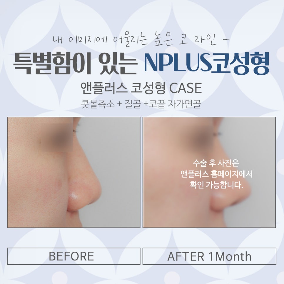 Carefully Checking a Rhinoplasty Clinic image 15