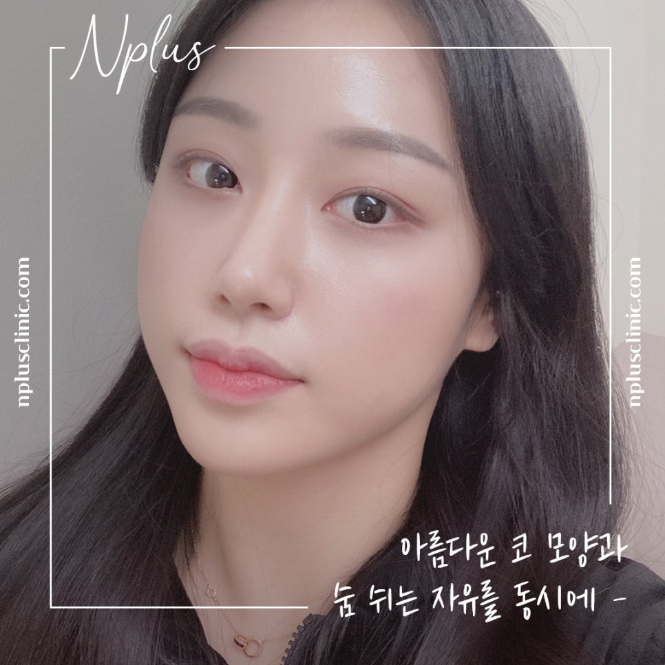 늑연골코수술을 통해 세련된 라인으로 관련 이미지 1