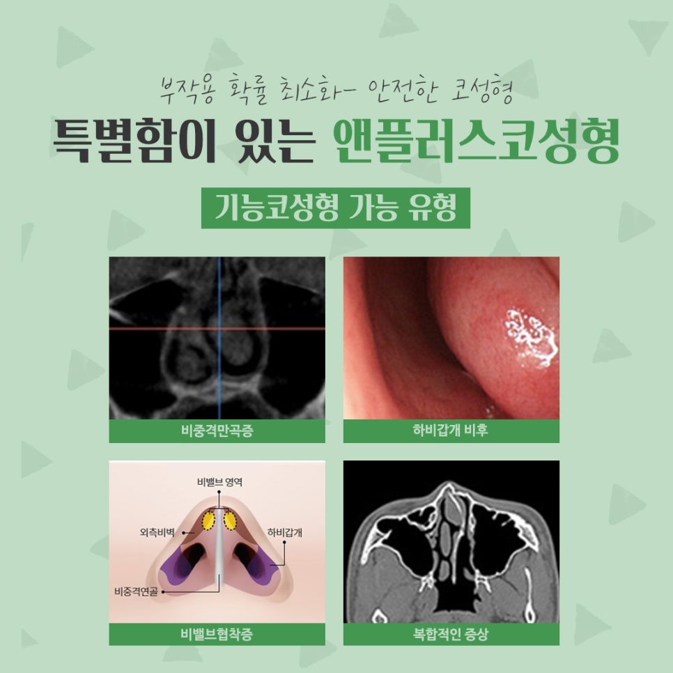 코성형후기 자연스럽고 예쁘게 관련 이미지 5