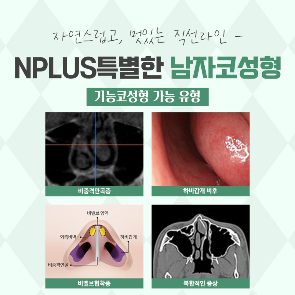 남자성형 잘 판단하고 결정 관련 이미지 5