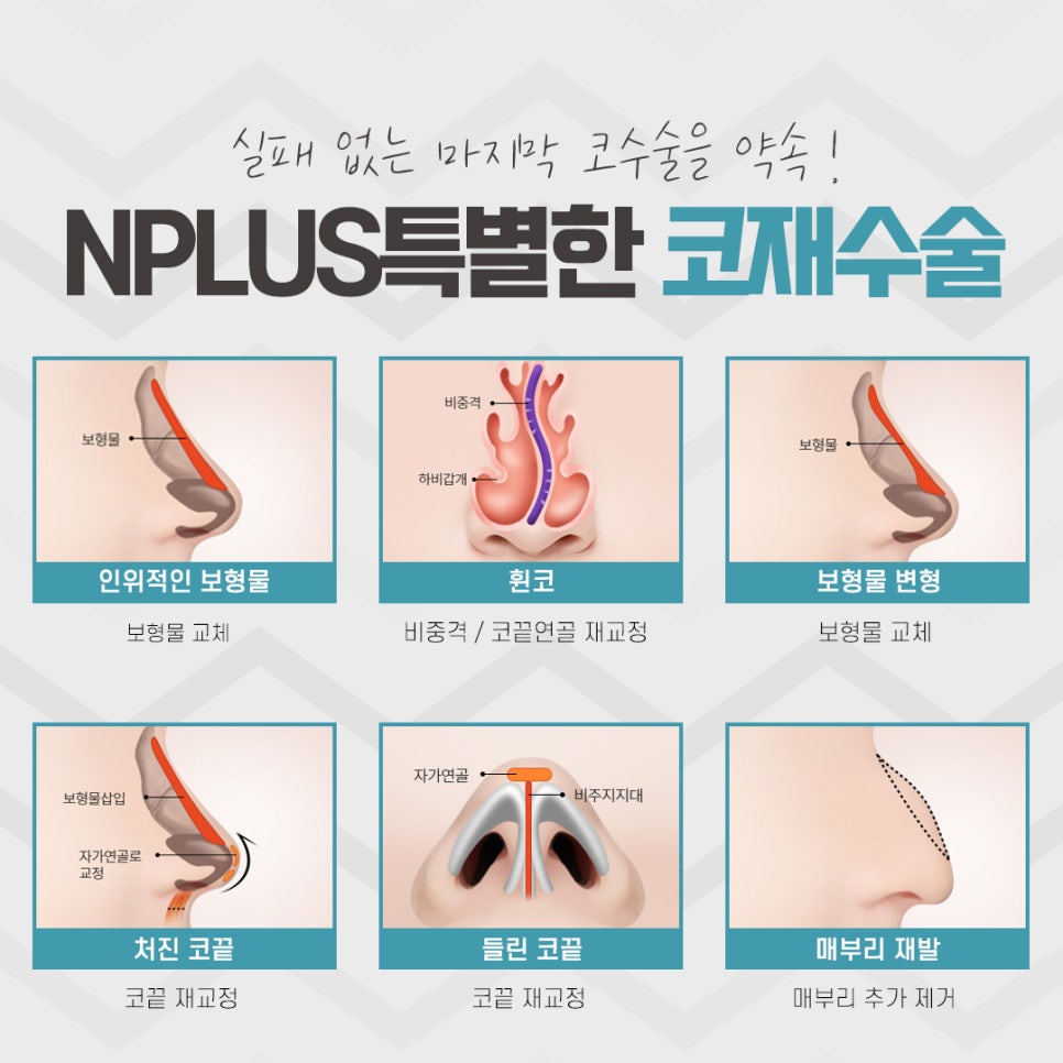 A Clear Difference in Revision Rhinoplasty Plastic Surgery Clinics image 5