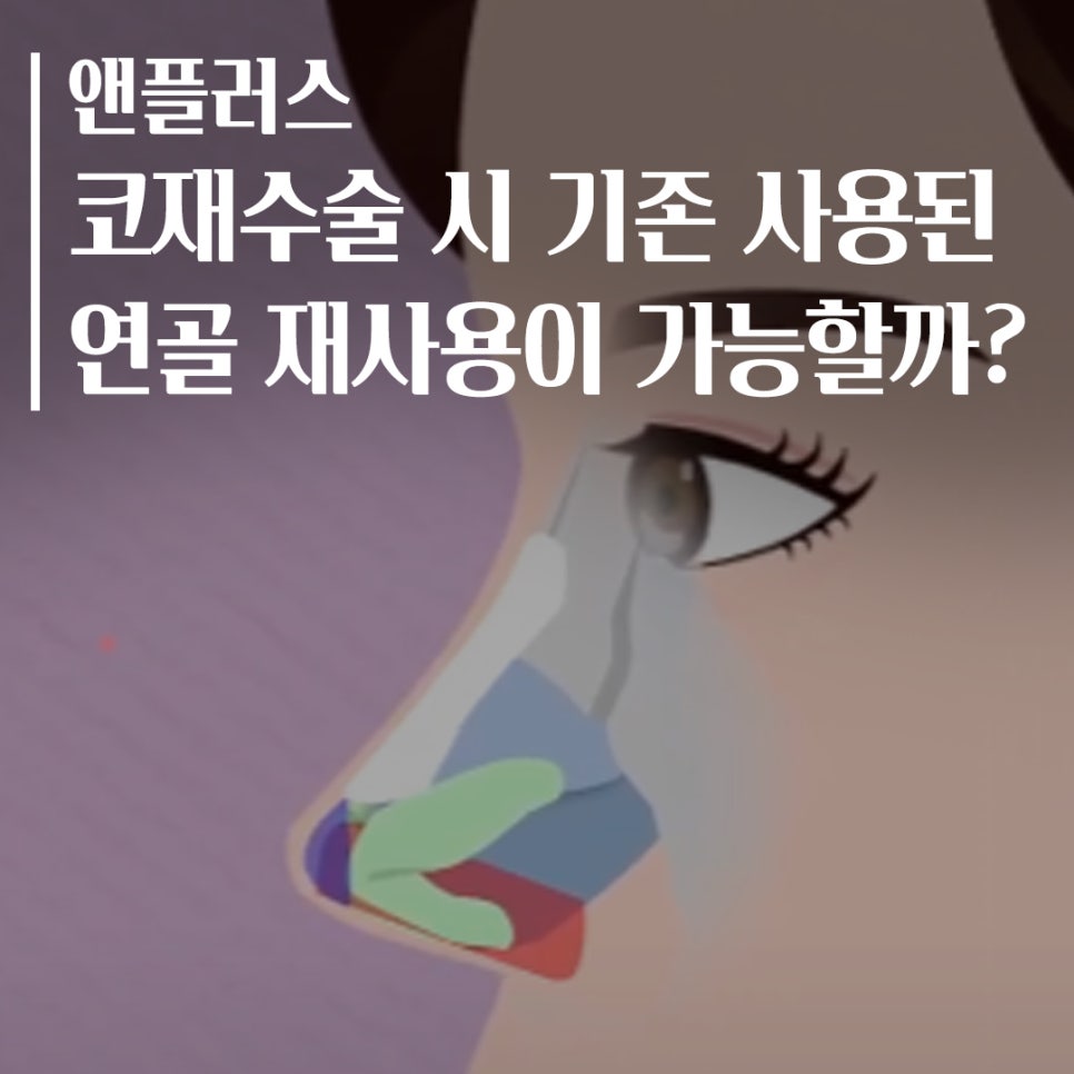 Let Us Explain Whether Cartilage Can Be Reused in Revision Rhinoplasty! image 1