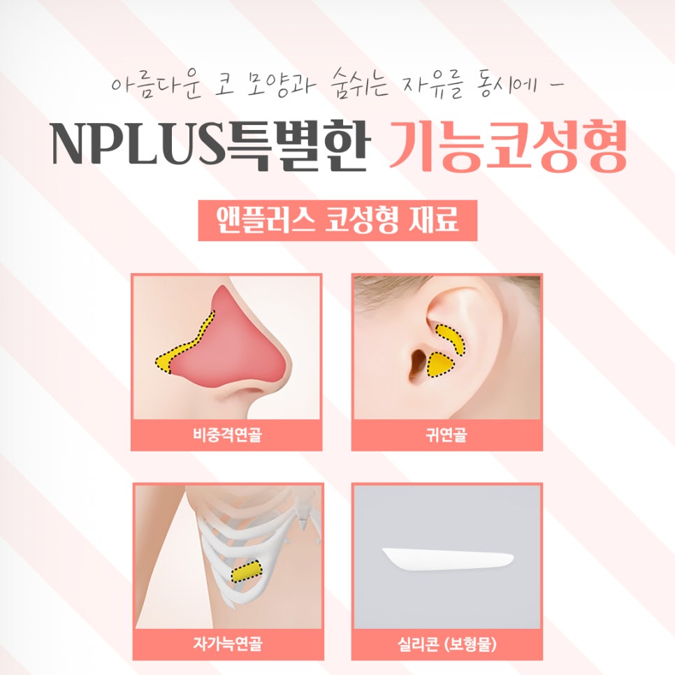 기능코성형후기 다양한 정보를 알아보고 관련 이미지 11