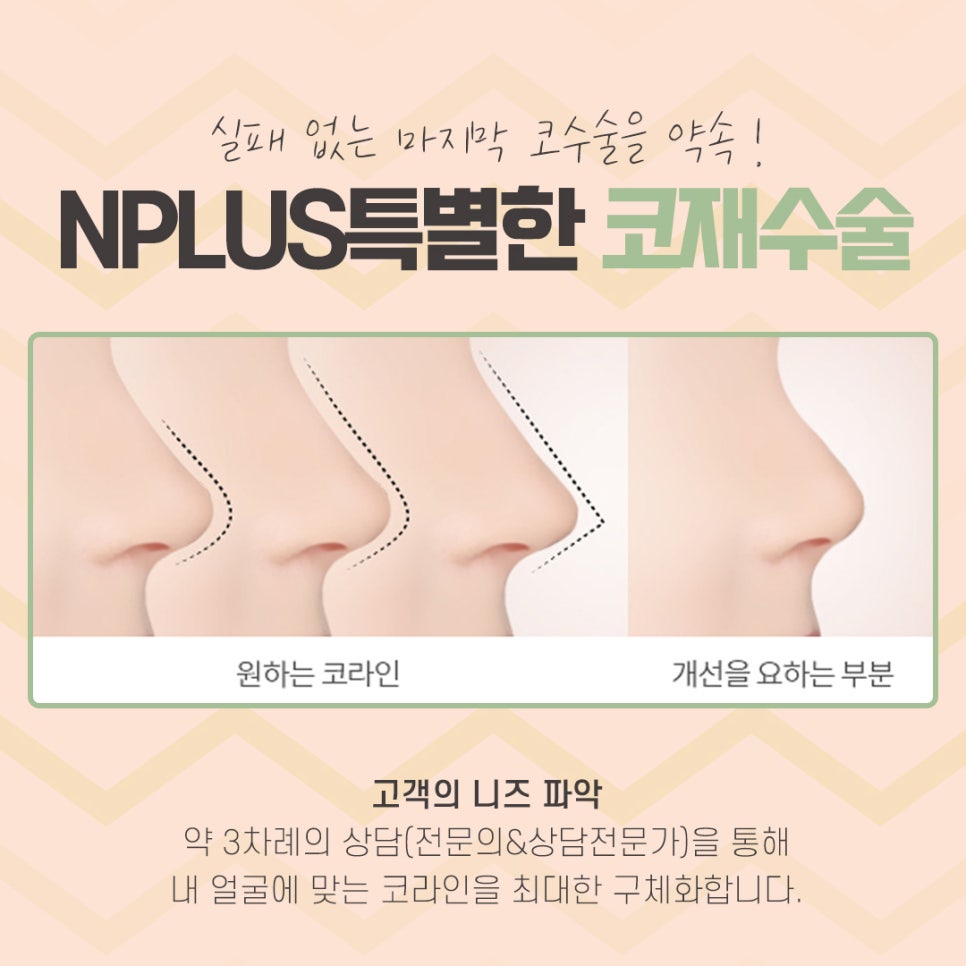 코재수술성형외과 잘 알아보고 결정해야 관련 이미지 5