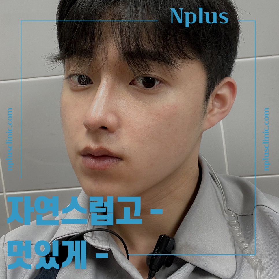 남자코수술전후 라인까지 고려하여 관련 이미지 2