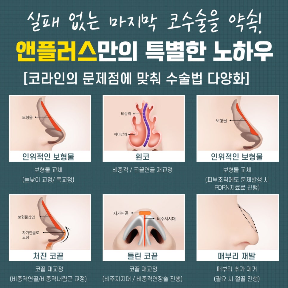Revision Rhinoplasty Review: A Choice You Won’t Regret image 5