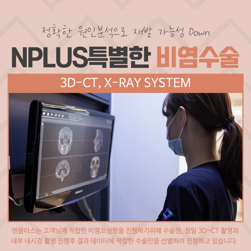 비중격수술후기 정확하게 파악해야 관련 이미지 9