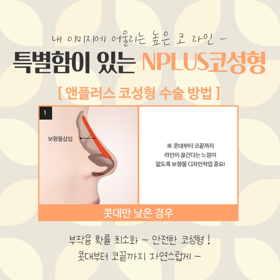 Looking into Reviews of Female Rhinoplasty in Detail image 9