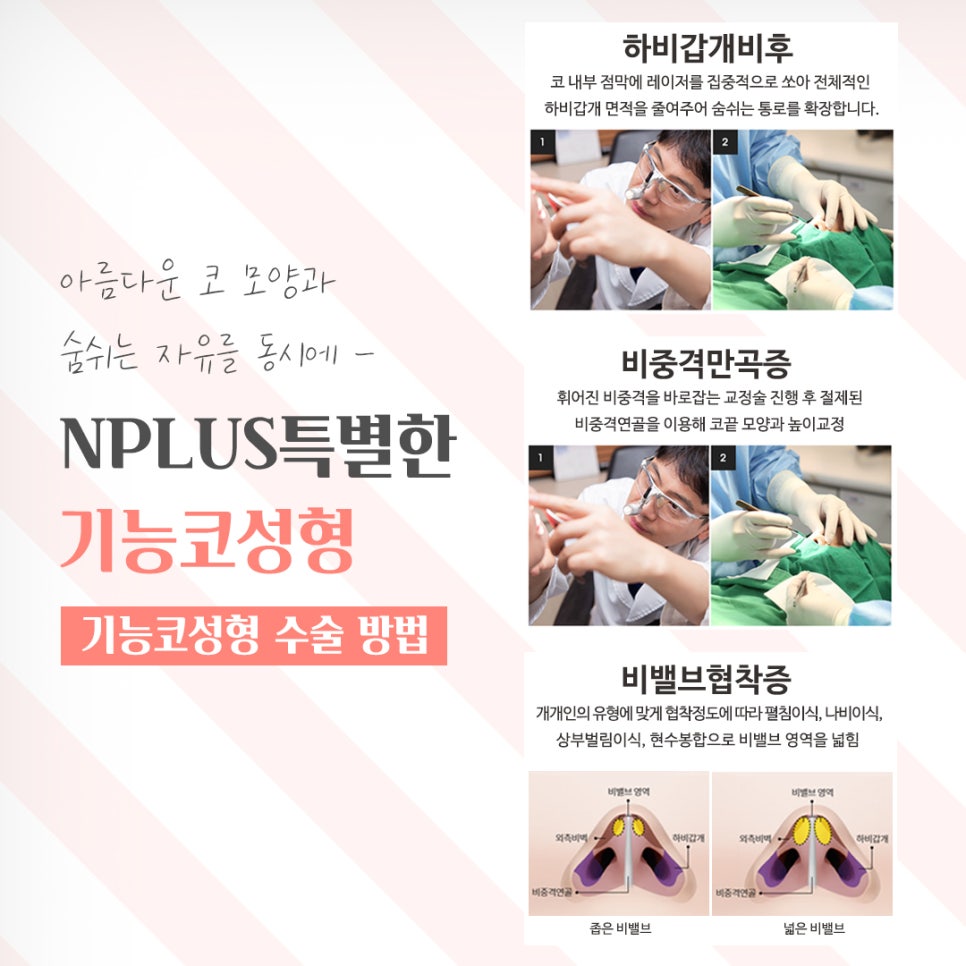 기능코성형후기 다양한 정보를 알아보고 관련 이미지 9