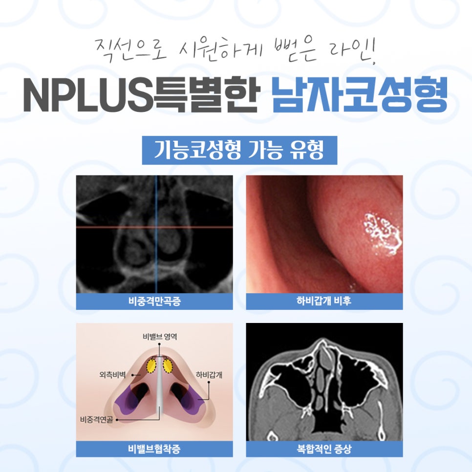 남자코성형전후 비교해 보고 관련 이미지 5