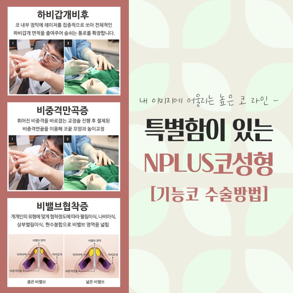 Check the Detailed Nose Surgery Review image 8