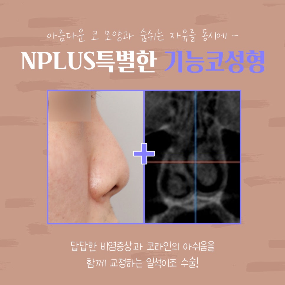 기능코수술후기 정확하게 알아보고 관련 이미지 4