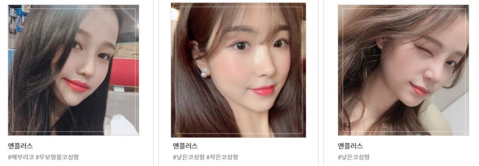 Hooked Nose Before-and-After Photos for a Softer Look image 12