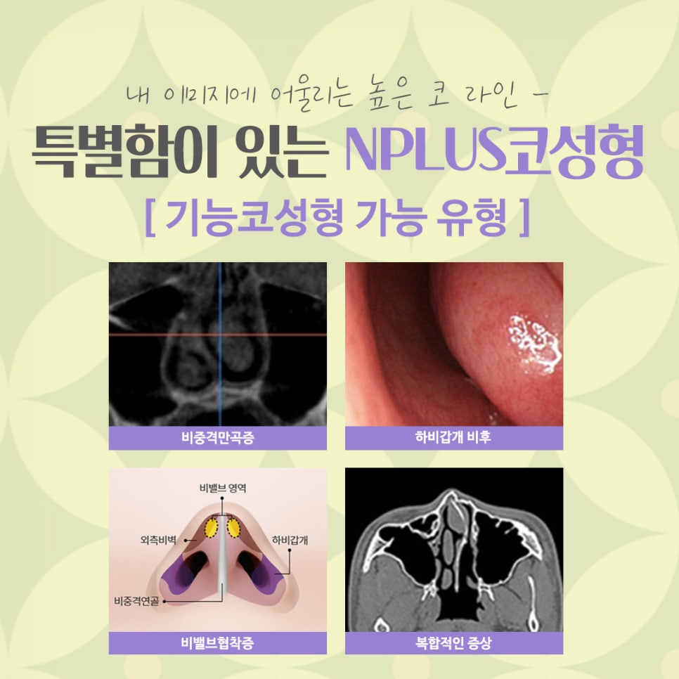 압구정코수술에 대해 찾아보고 관련 이미지 5