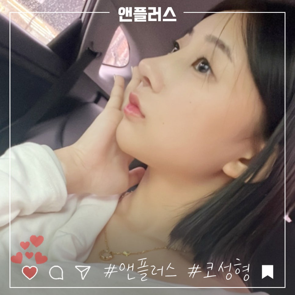 앤플러스의원에서 전해드리는 코성형후기 관련 이미지 2