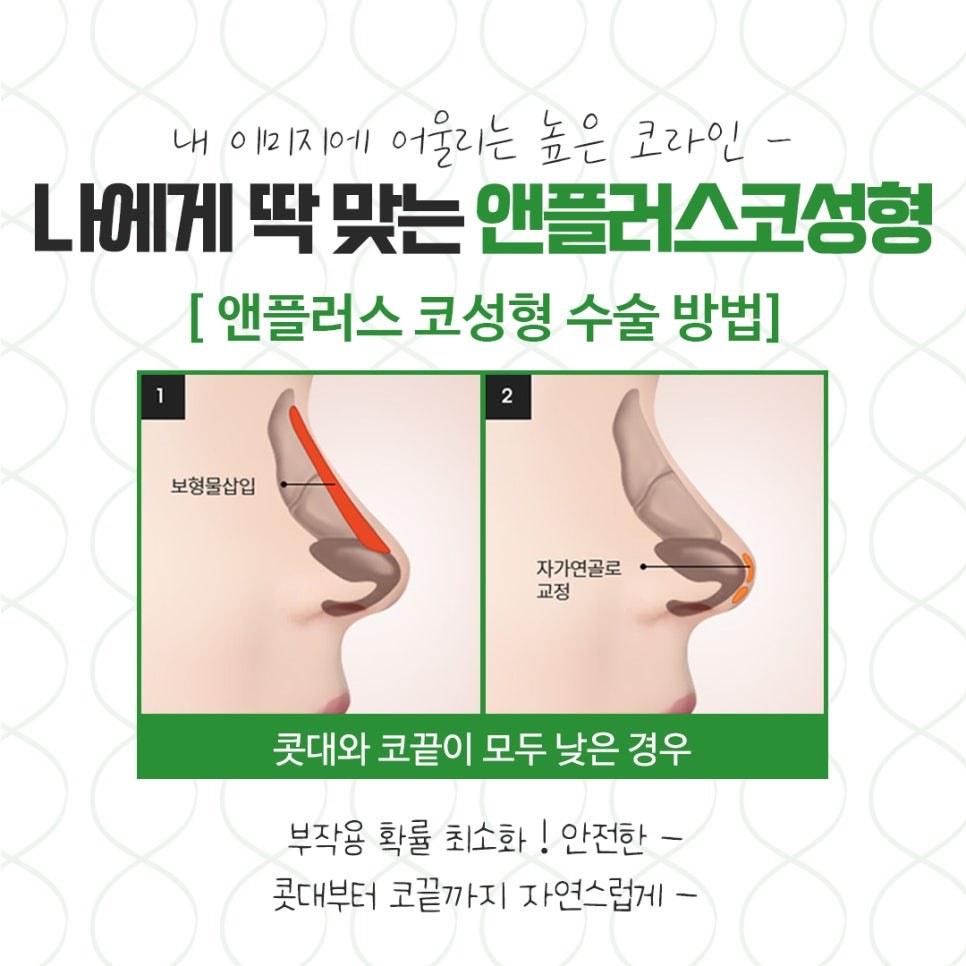 코뼈골절 다양한 방법으로 관련 이미지 7