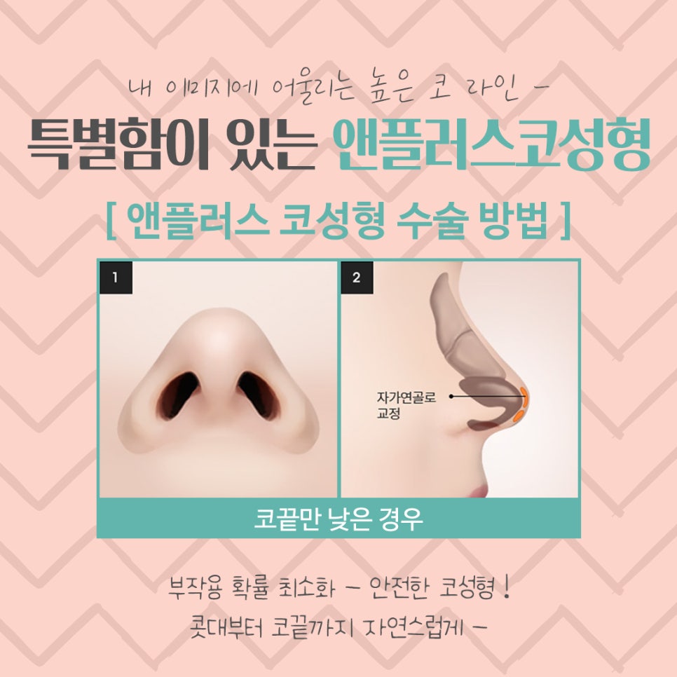 Nose Surgery Review Considering the Straight-Humped, Straight-Half-Moon Line image 12