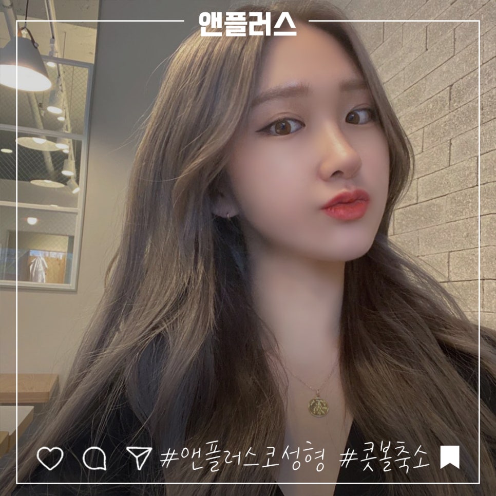 콧볼축소후기_넓은콧볼 고민해결 관련 이미지 1