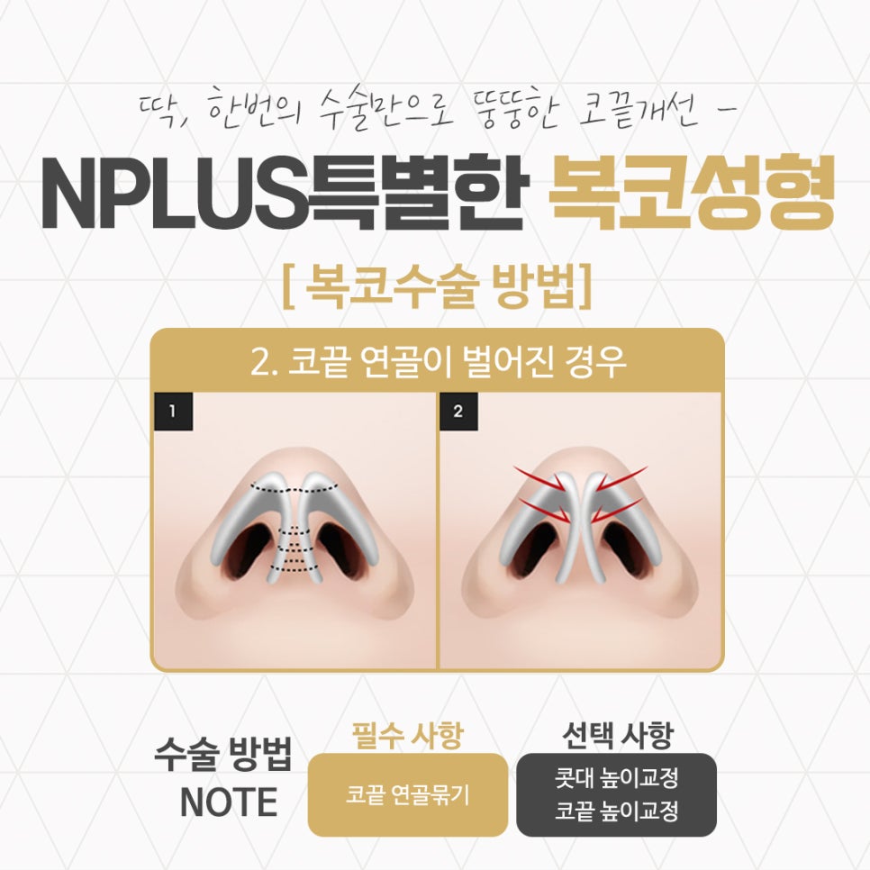 Understanding the Cause of Bulbous Nose Surgery Accurately image 9