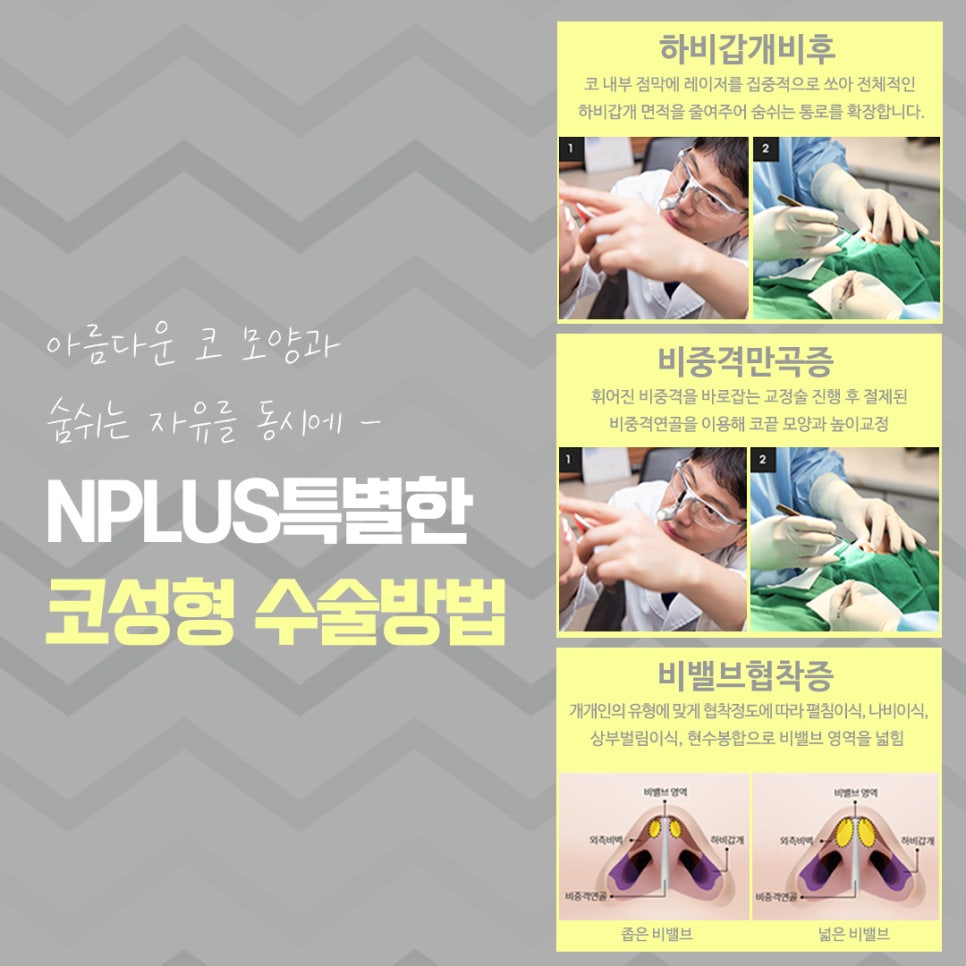 코수술전후 확실한 변화로 관련 이미지 10