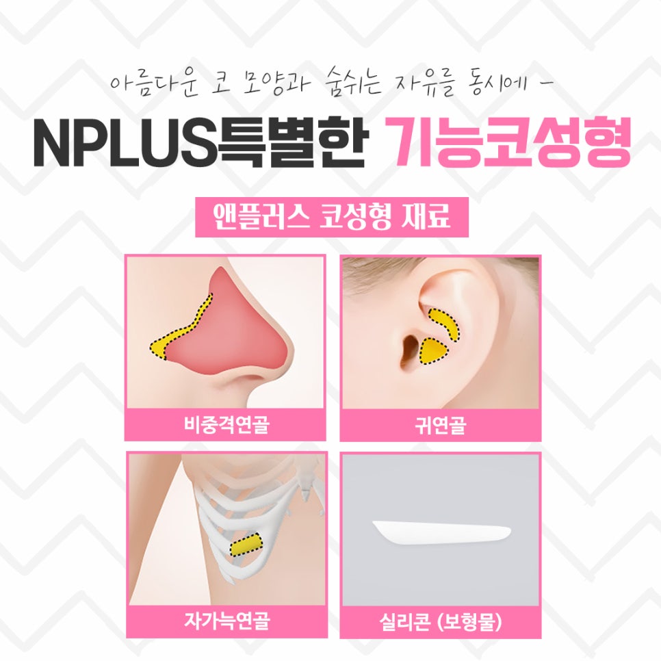기능코수술후기 정확한 진단을 통해 관련 이미지 11