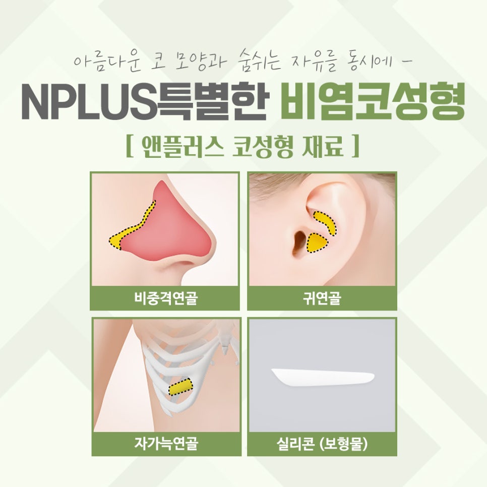 비염코수술후기에 대해 확인하여 관련 이미지 8