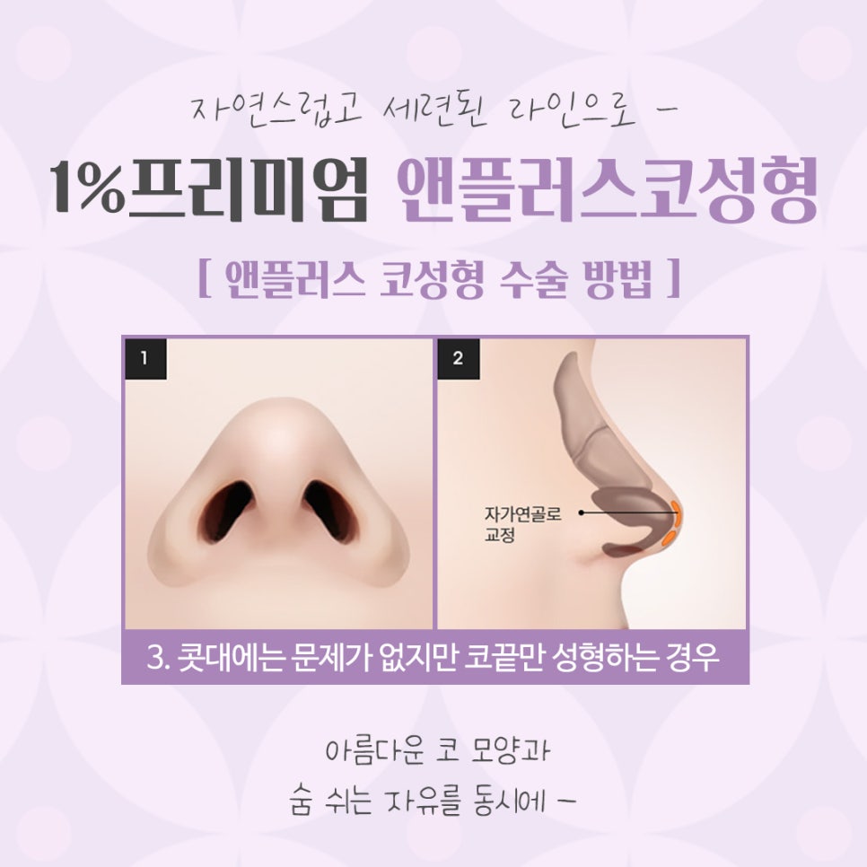 늑연골 코수술 자세하게 알아보고 관련 이미지 10