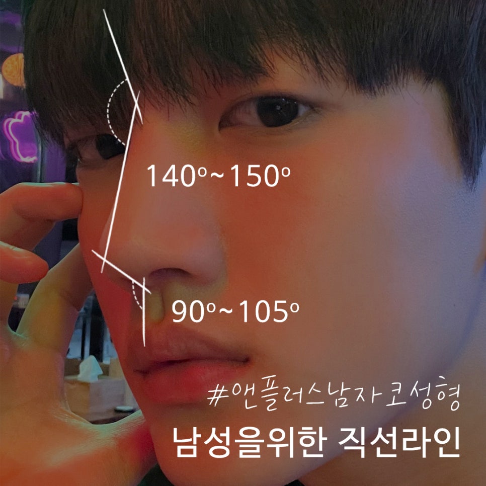 남자성형 자연스럽고 멋있게 관련 이미지 4