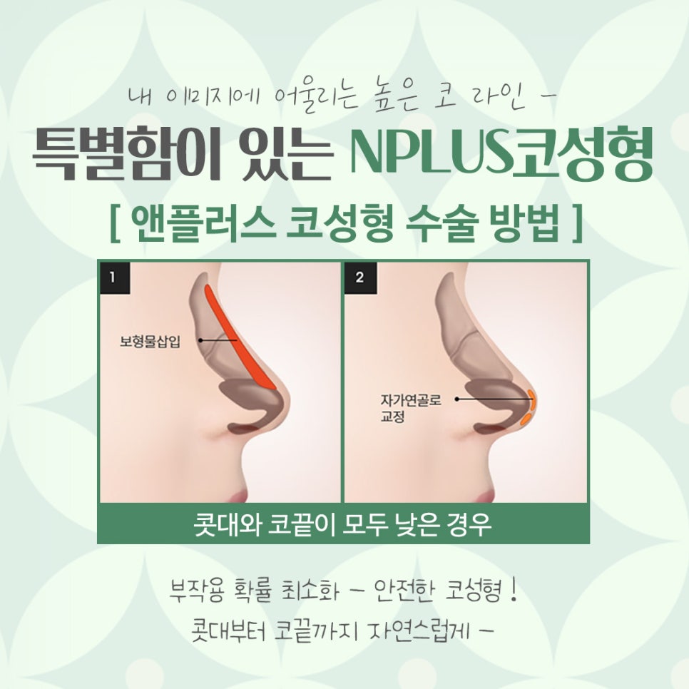서울코성형잘하는곳 개인의 이미지를 고려하여 관련 이미지 7