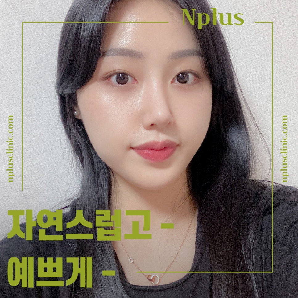 코성형전후를 찾아본다면 관련 이미지 1
