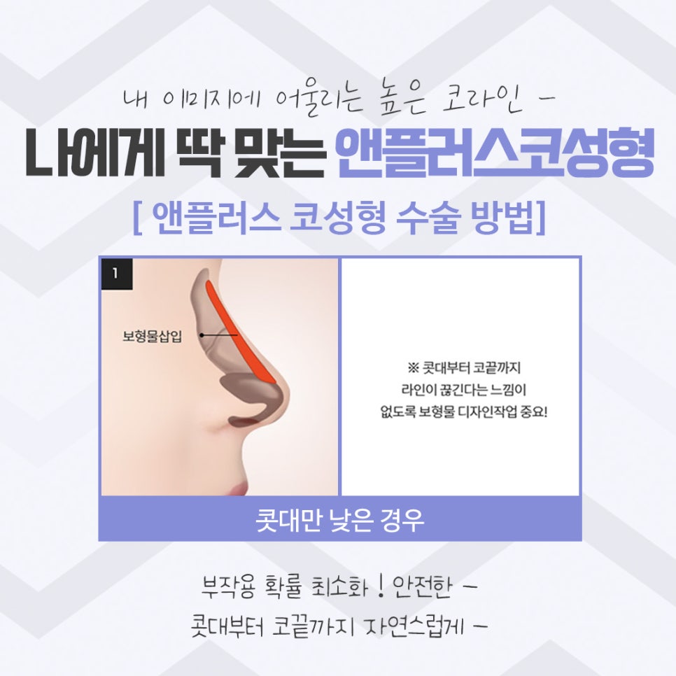 코성형후기 이미지를 예쁘고 자연스럽게 관련 이미지 9