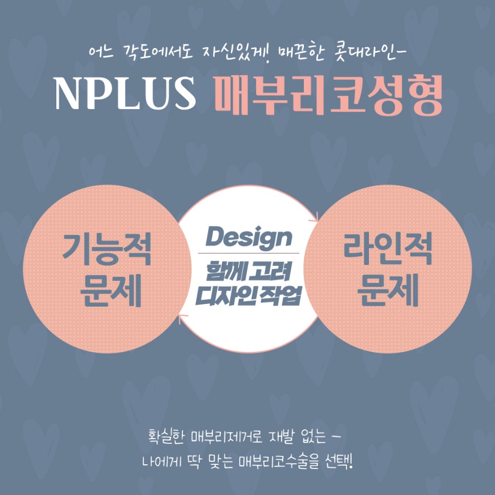 매부리코수술 후기까지 확인하고 관련 이미지 9