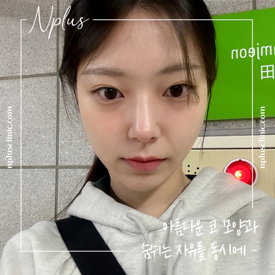 Looking at the Differences in Nose Tip Surgery Reviews image 2