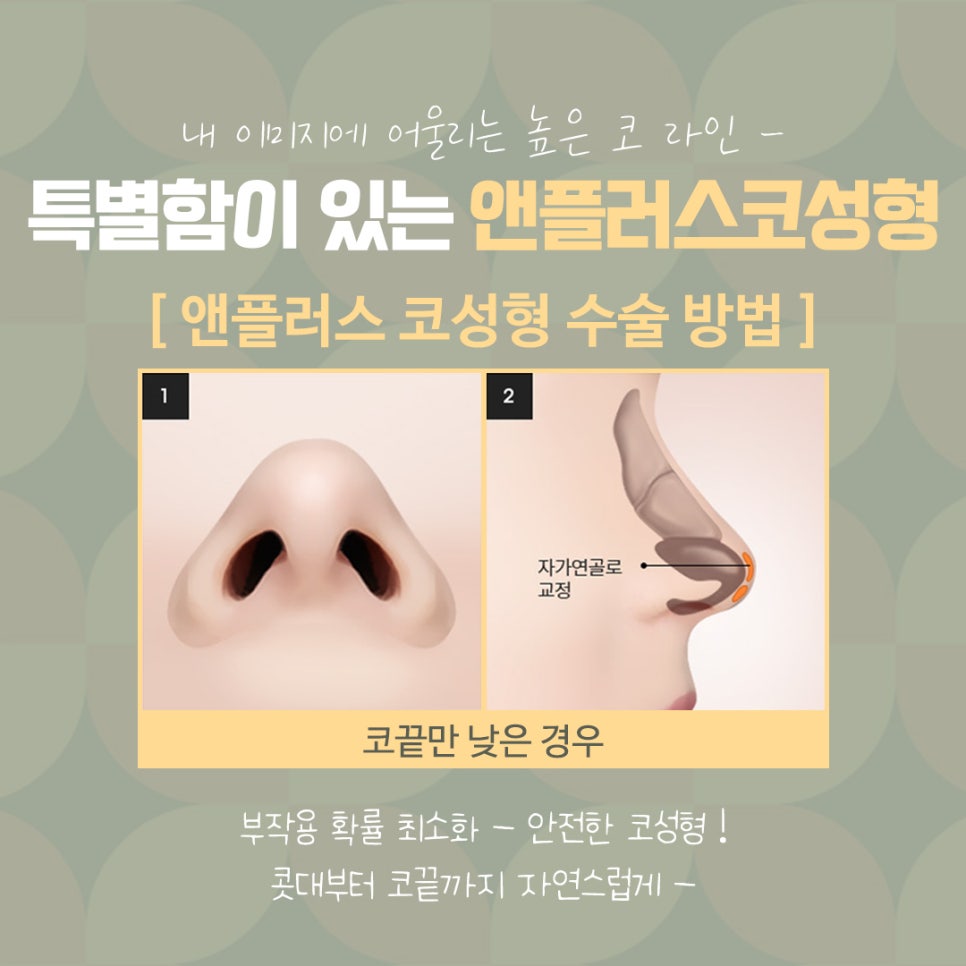 직반버선코 라인으로 교정된 코수술후기 관련 이미지 12
