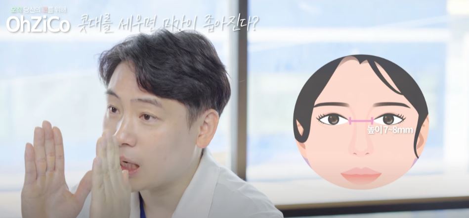 코성형 후 눈몰림 걱정된다면? 관련 이미지 14