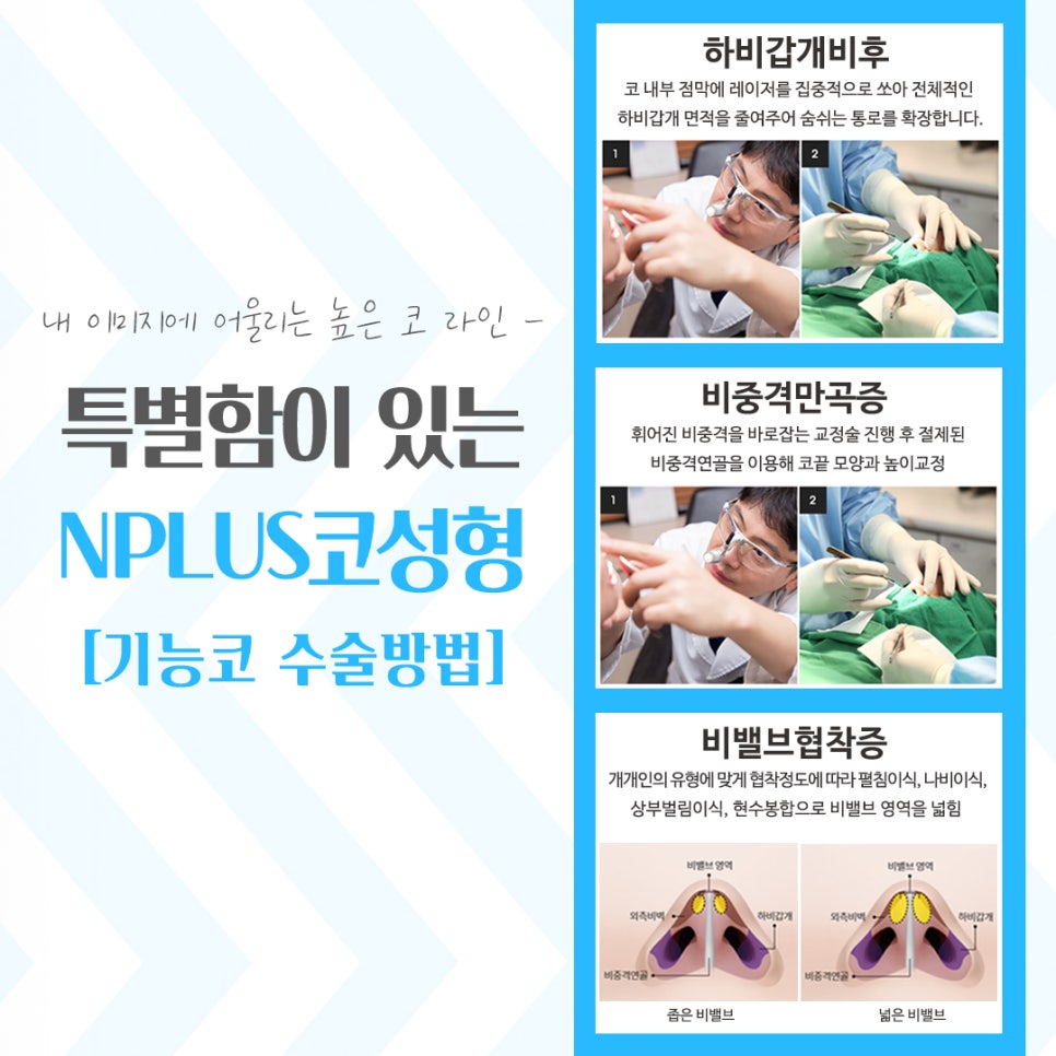 코성형잘하는곳에서 차이를 알아보고 관련 이미지 9