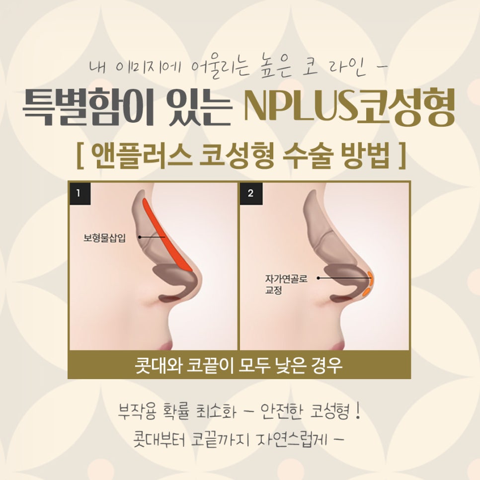 코수술병원을 꼼꼼하게 체크하여 관련 이미지 8
