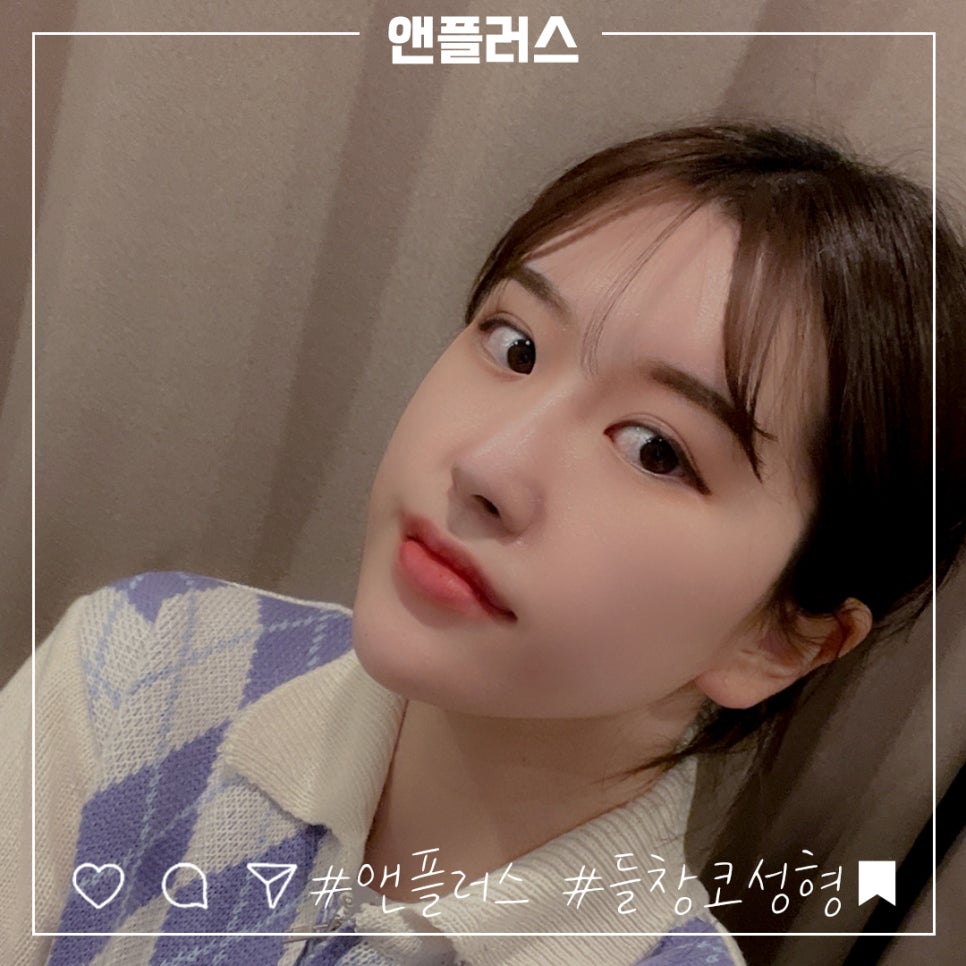 짧은코수술 후기까지 확실하게 관련 이미지 2