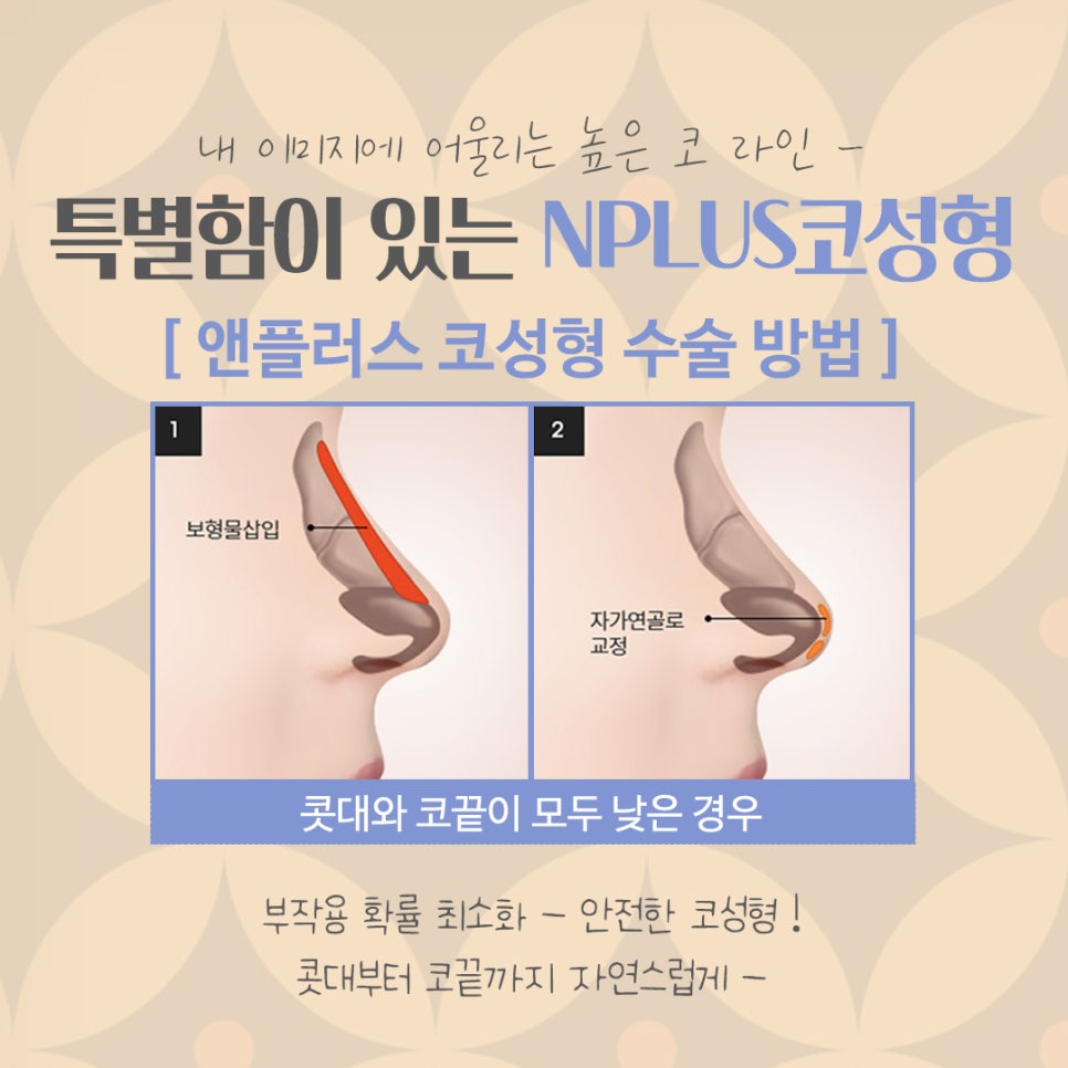 코성형후기 내부 기능까지 확실하게 관련 이미지 8